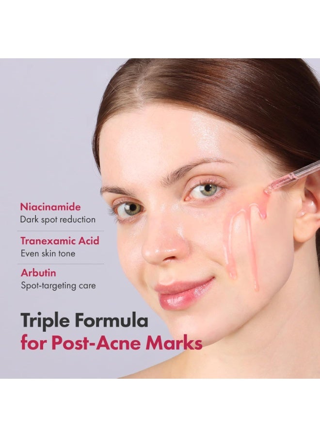 KOEC Niacinamide 10% + TXA 4% Serum 30ml, for Sensitive skin, Korean Glass Skin, Fragrance-Free - Image 2